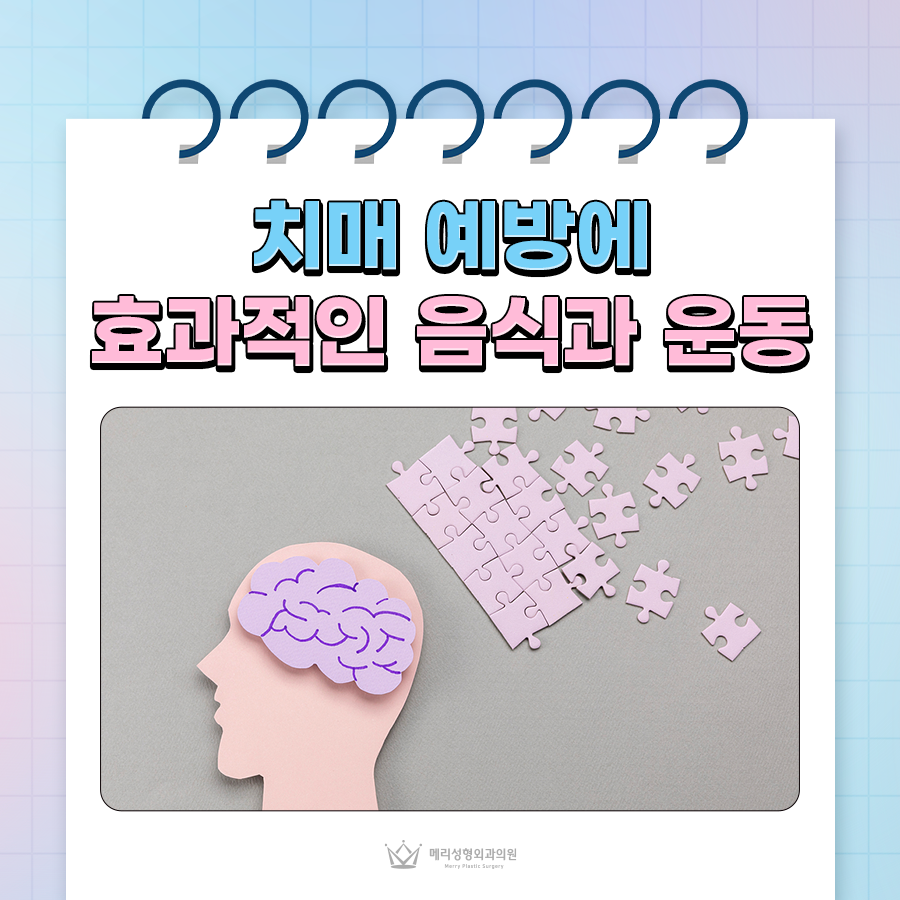 Foods and Exercises That Help Prevent Dementia, and How to Protect Brain Health! image 1