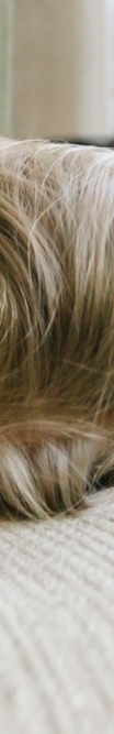 Carefully Managing Midlife Eye Sagging and Crow’s Feet with Thread Lifting image 21