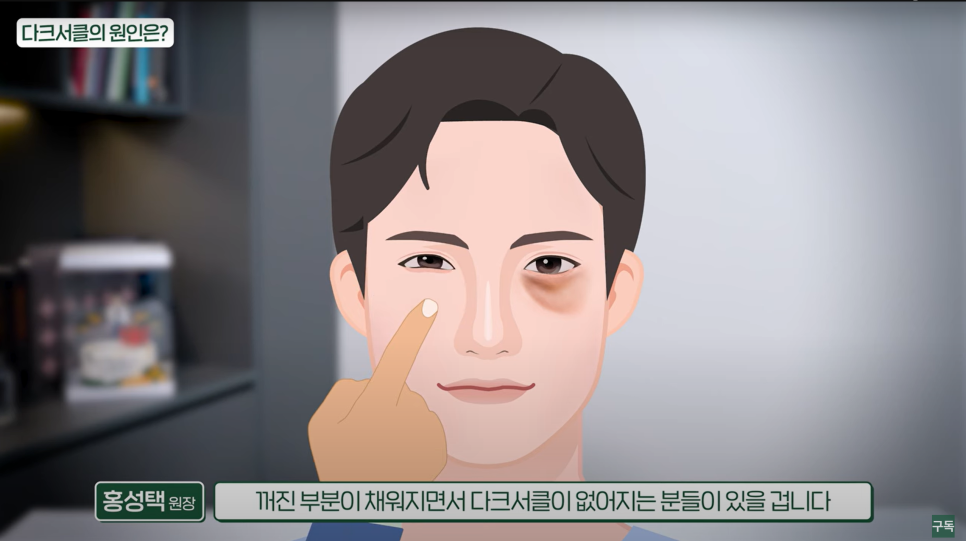 다크서클, 아무리 노력해도 안 없어지던 이유는 바로 이것! 관련 이미지 7