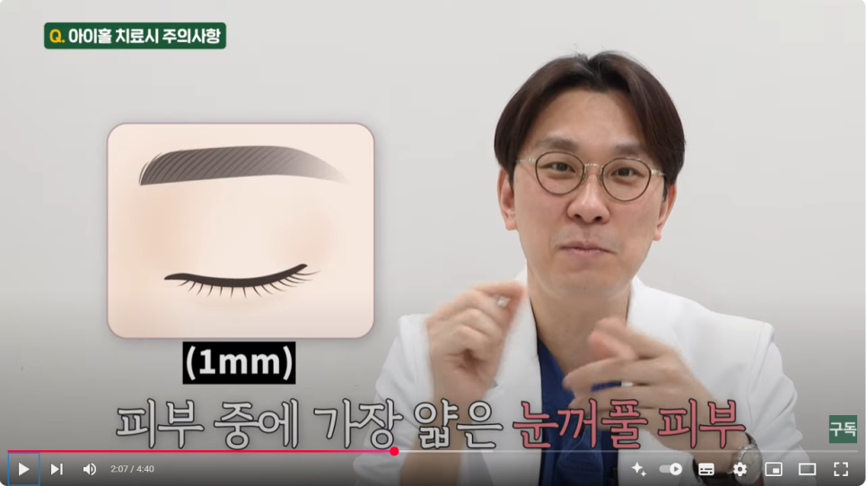 Sunken Upper Eyelids, Eye Hollow :: Filling with Filler, Side Effects, Drooping Eyelids, Gubonseung’s Sunken Upper Eyelids, Lee Dong-wook’s Eye Hollow, Double and Triple Eyelids image 4
