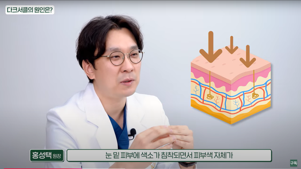 다크서클, 아무리 노력해도 안 없어지던 이유는 바로 이것! 관련 이미지 4