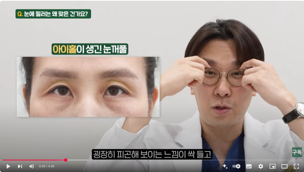 Sunken Upper Eyelids, Eye Hollow :: Filling with Filler, Side Effects, Drooping Eyelids, Gubonseung’s Sunken Upper Eyelids, Lee Dong-wook’s Eye Hollow, Double and Triple Eyelids image 3