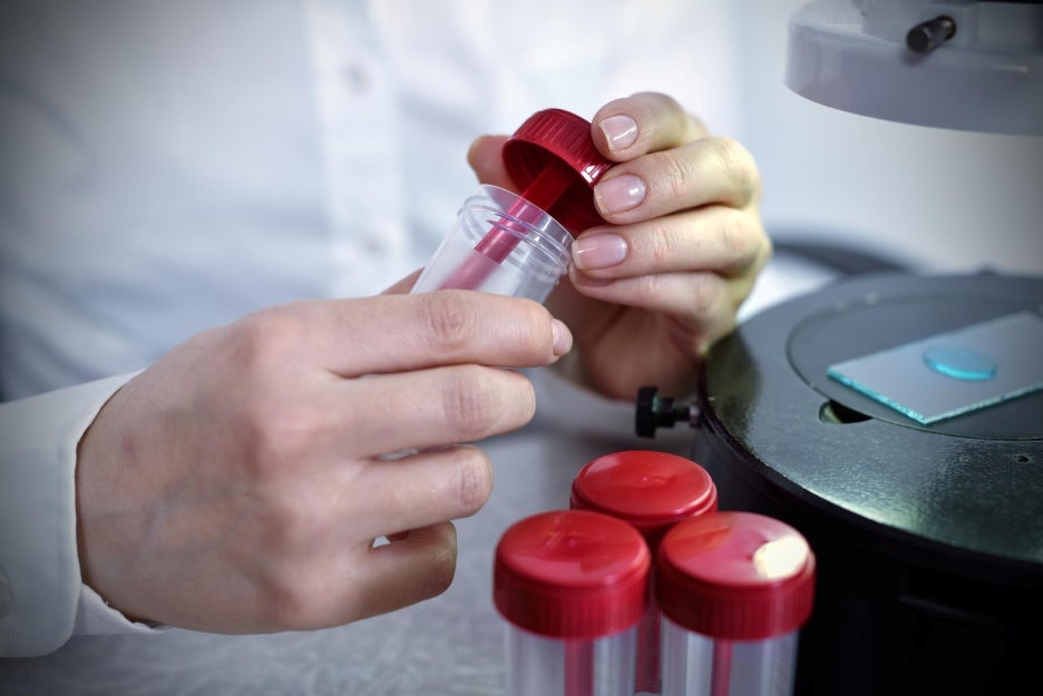 What Are the Normal HbA1c Levels, and How Can You Lower Blood Sugar? image 6