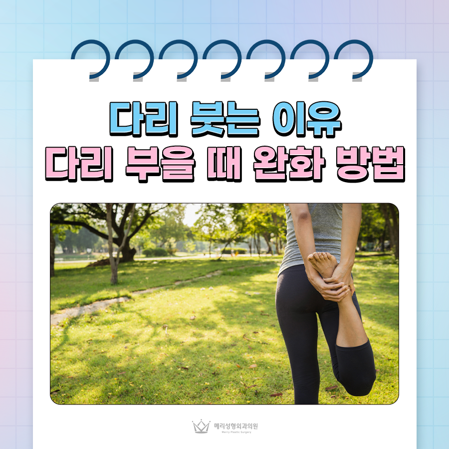 Why Do Legs Swell, and How Can You Relieve It When Pain and Numbness Appear? image 1