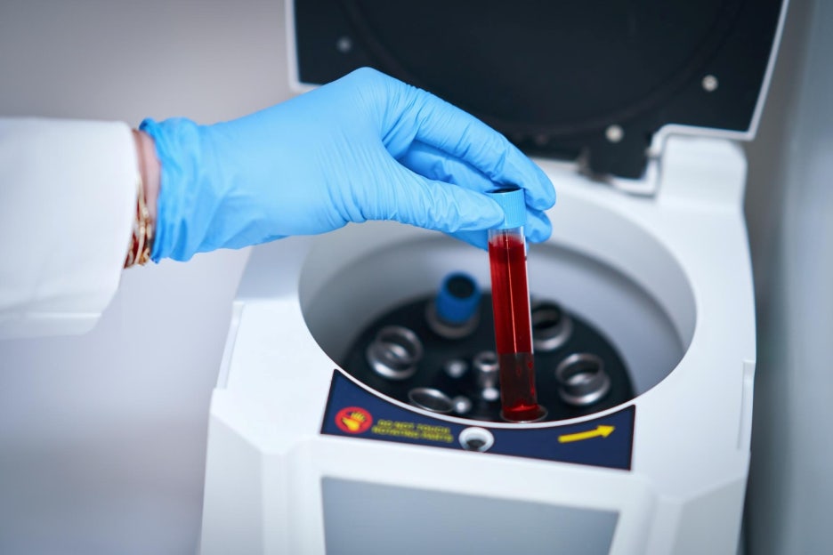 What Are the Normal HbA1c Levels, and How Can You Lower Blood Sugar? image 3
