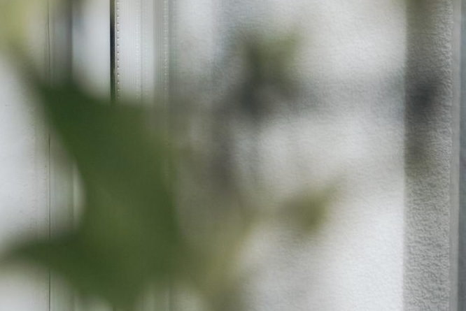 실루엣실리프팅 잘하는곳 내 피부를 생각한 맞춤 리프팅 관련 이미지 16