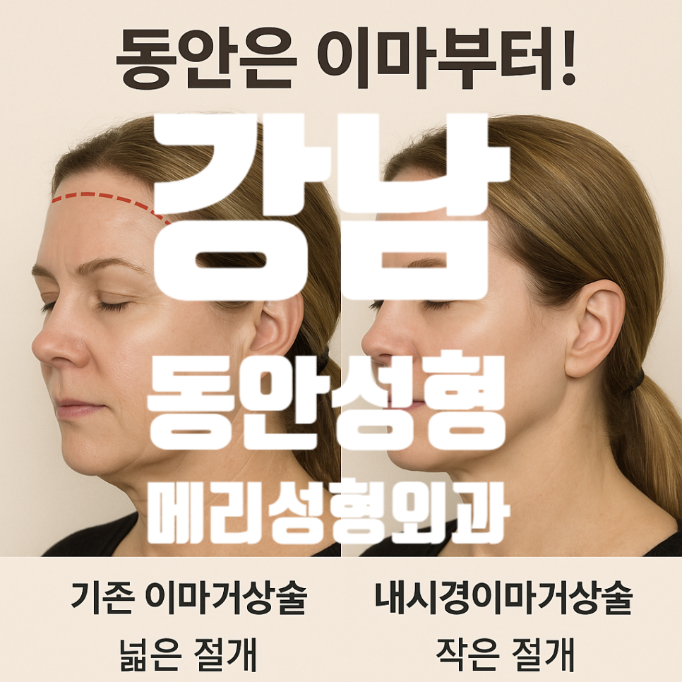 강남동안성형외과 어디가 잘해요? 흉터 걱정 없는 내시경이마거상, 이마부터 리프팅 해야 되는 이유부터 수술이 필요한지 자가체크리스트까지 관련 이미지 2