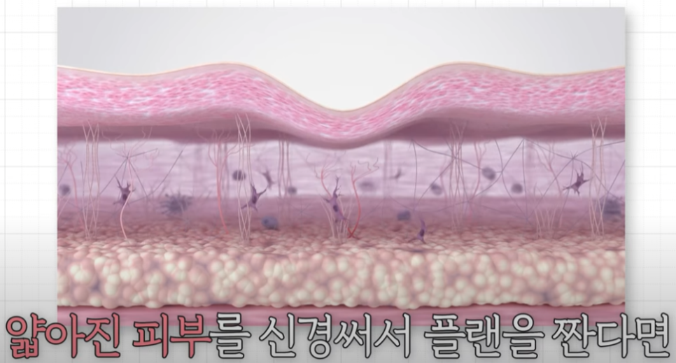 중년 코성형/코재수술 ::  안전하고 자연스럽게 부작용은 최소화 관련 이미지 2