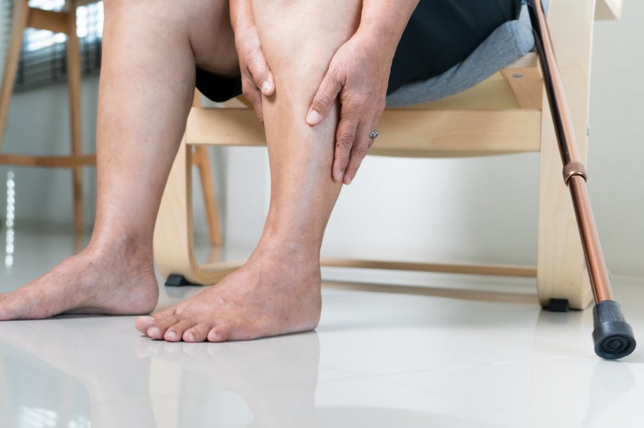 Why Do Legs Swell, and How Can You Relieve It When Pain and Numbness Appear? image 2