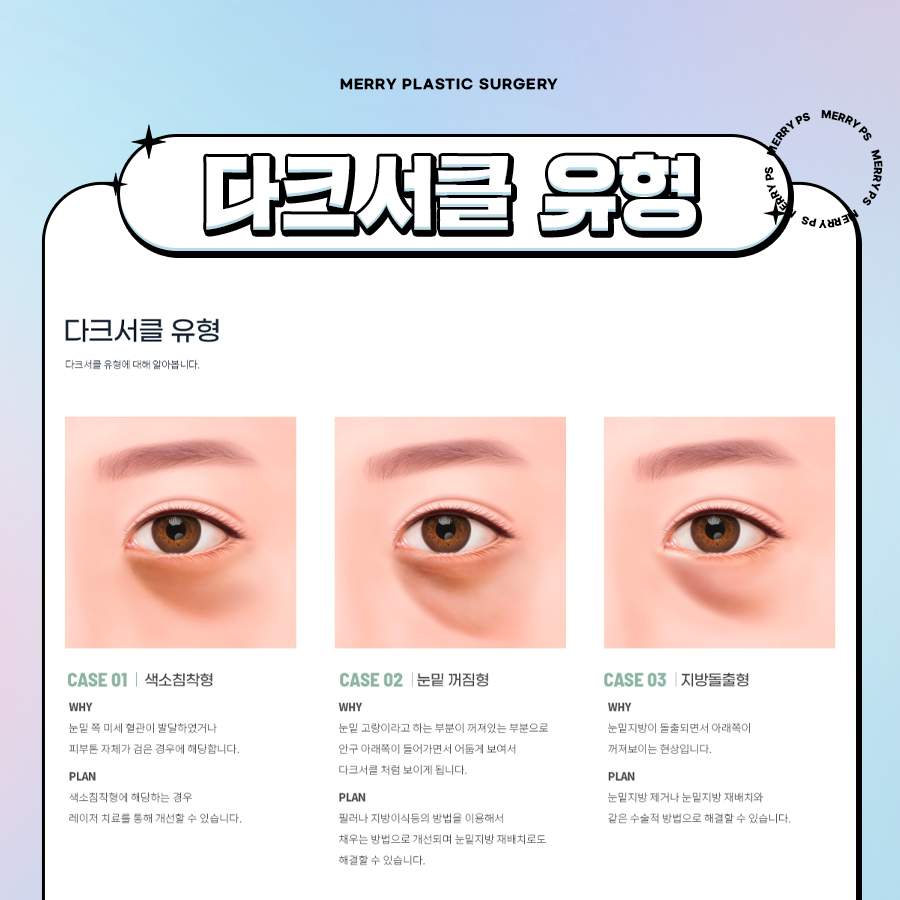 신사동 눈밑지방재배치 연령대별로 다른 원인과 증상에 따라 관련 이미지 2