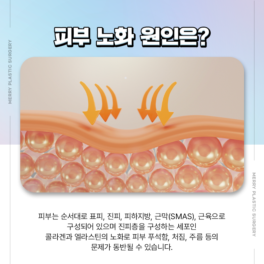 Nonhyeon V-Line Thread Lifting with Powerful Results Without Incisions image 3
