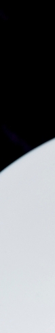 Merry Non-Implant Rhinoplasty, Preserving the Characteristics of Autologous Tissue image 13