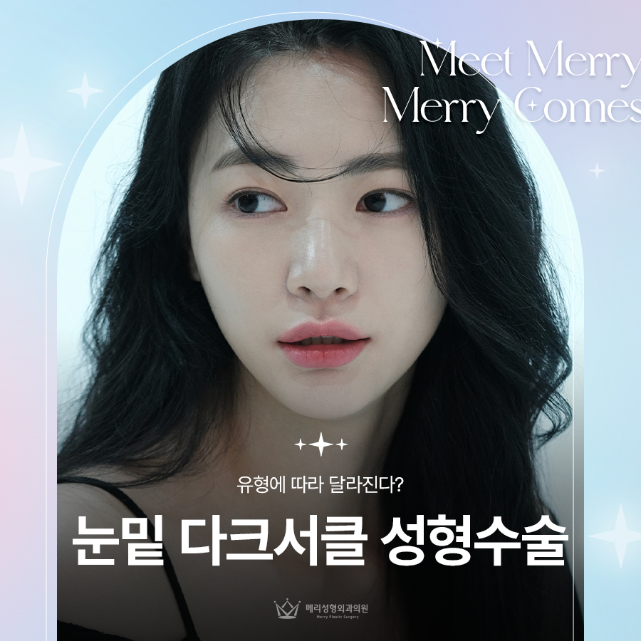 눈밑 다크서클 성형수술 유형에 따라 달라진다? 관련 이미지 1