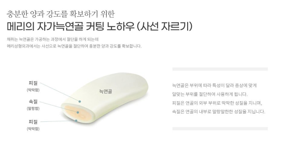 자가늑연골 코재수술 메리에서 마지막이 될 수 있도록 관련 이미지 5