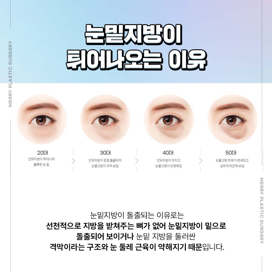 메리 눈밑지방재배치로 불룩한 눈밑을 생기있게 관련 이미지 2