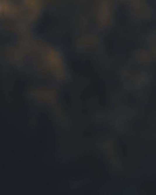 환절기 비염 이유 증상 관리방법 관련 이미지 14