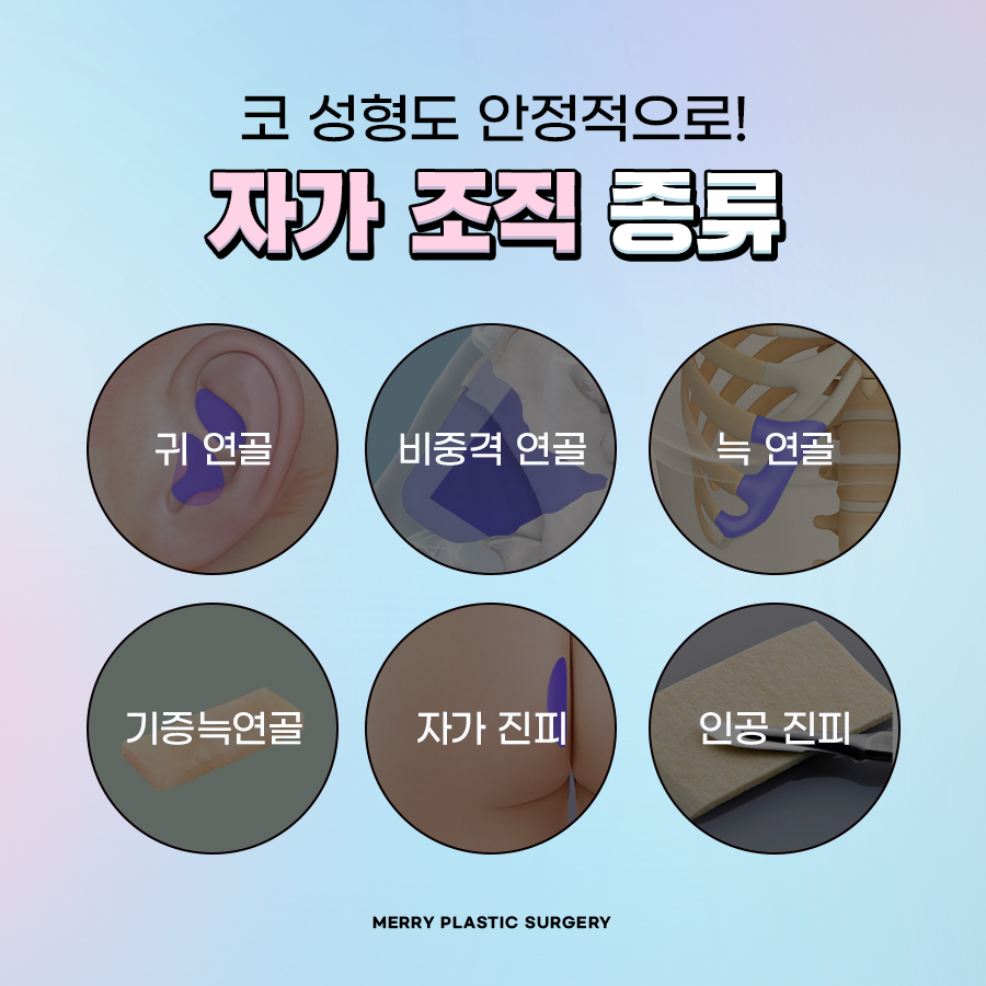 압구정역 코성형 보형물 걱정 없는 자연스러운 코 관련 이미지 4