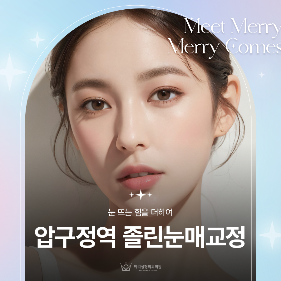 Making It Easier to Open the Eyes at Apgujeong Station for Sleepy-Eyed Correction image 1