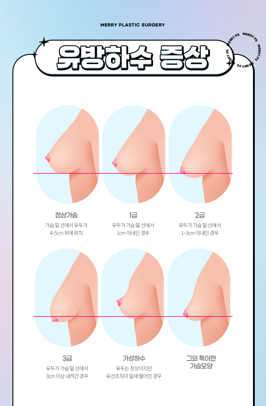 유방하수 교정수술 출산 후 처진 가슴 고민이라면 관련 이미지 3