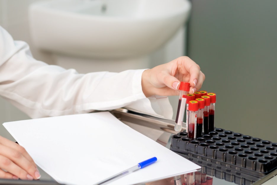 What Are the Normal HbA1c Levels, and How Can You Lower Blood Sugar? image 4