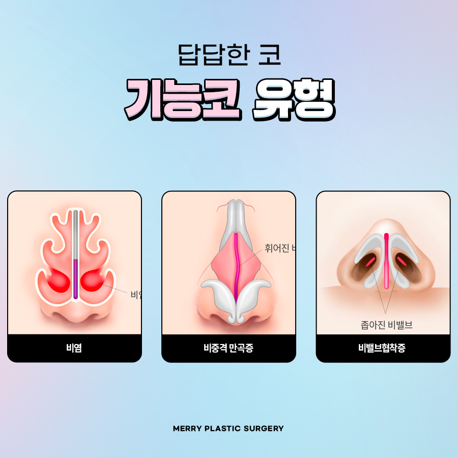 압구정 기능적 코성형 질환과 예쁜 코 모양을 동시에 관련 이미지 3
