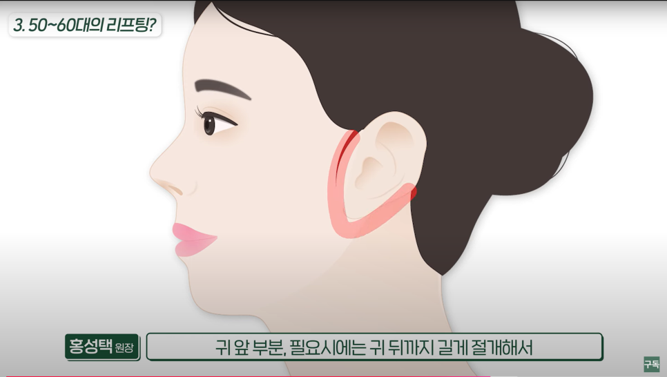 안티에이징, 슬루우에이징, 저속노화 :: 관리의 모든 것 :: 관련 이미지 4