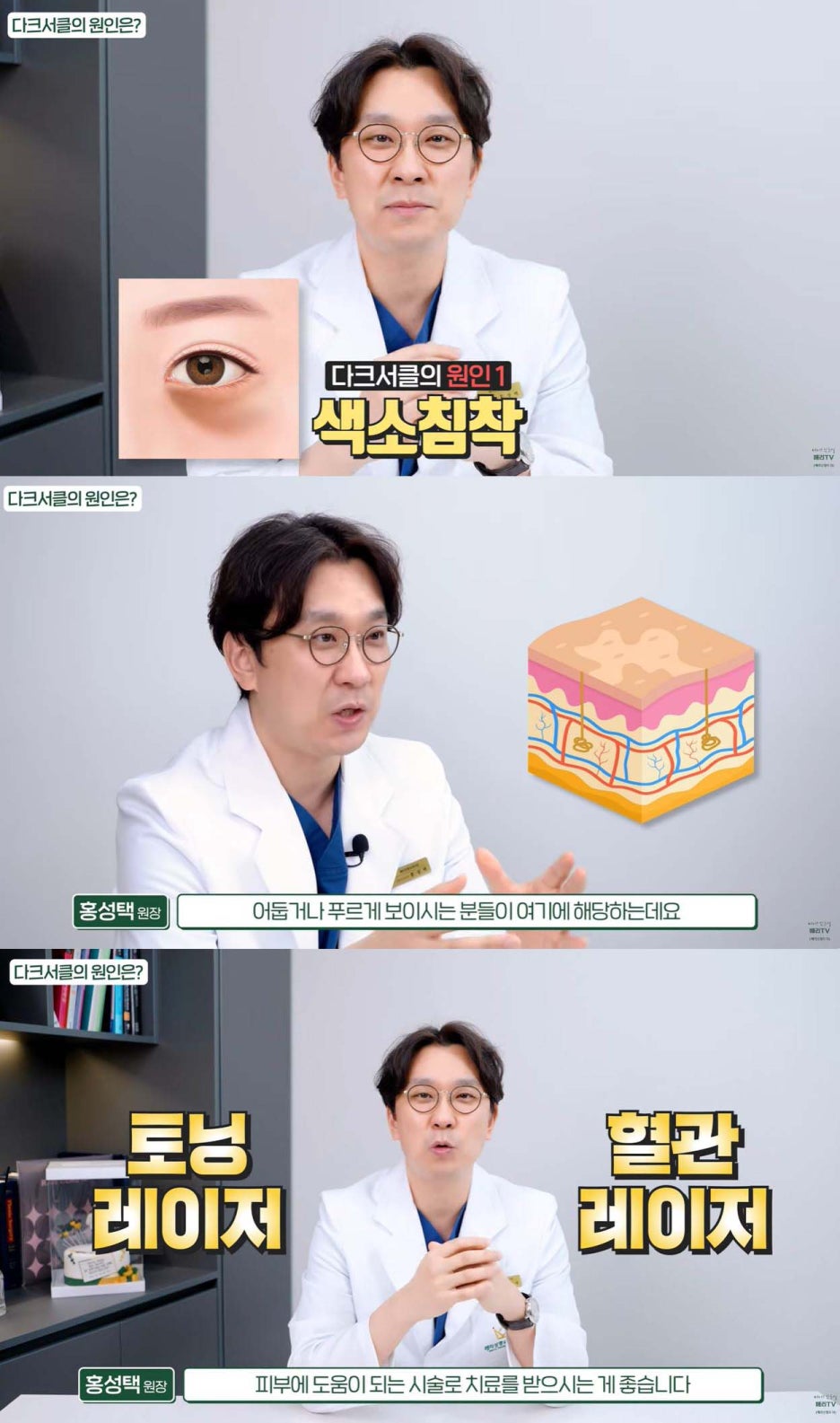 중년눈밑지방재배치수술 다크서클 개선할 수 있는 경우 관련 이미지 3
