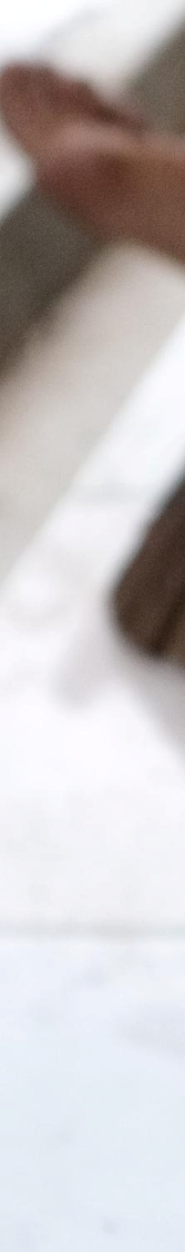 신논현 비주교정수술 코끝에 따라 달라지는 코 모양 관련 이미지 12