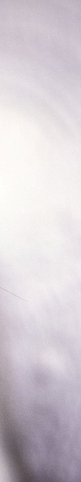 Types of Functional Rhinoplasty Near Sinsa Station: For a Beautiful Nose That’s Easy to Breathe Through! image 22