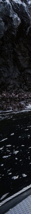 Why Do Legs Swell, and How Can You Relieve It When Pain and Numbness Appear? image 7