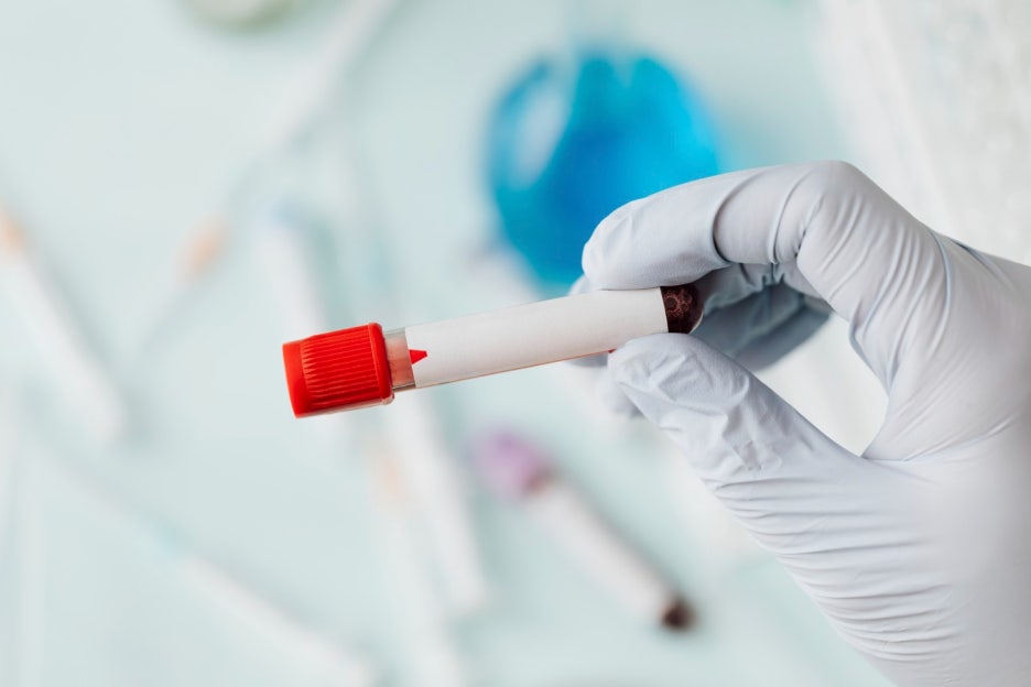 What Are the Normal HbA1c Levels, and How Can You Lower Blood Sugar? image 5