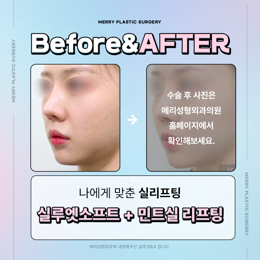 신사역 실리프팅 효과로 자연스럽게 탄력 회복을 관련 이미지 5