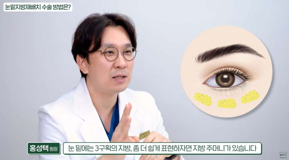 중년눈밑지방재배치수술 다크서클 개선할 수 있는 경우 관련 이미지 7