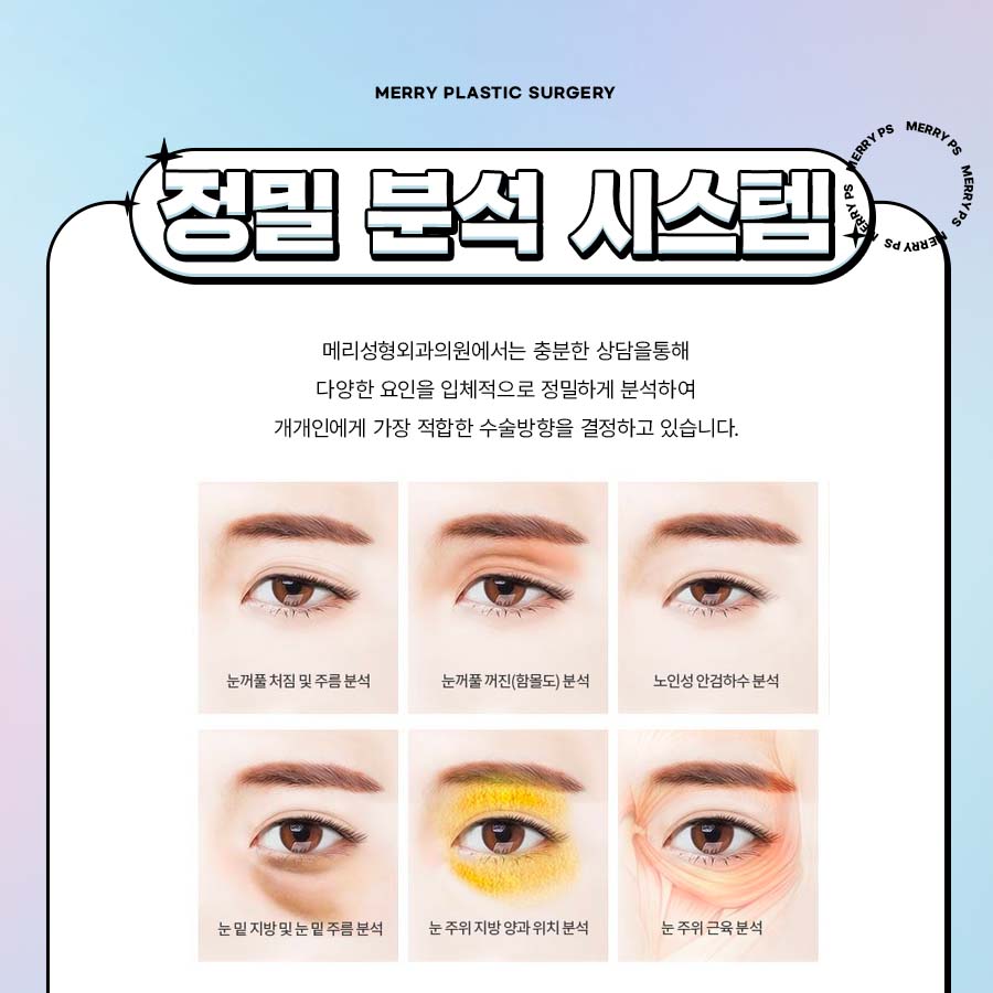 Smooth Bulging Under-Eyes with Lower Blepharoplasty for Middle-Aged Eyes image 4