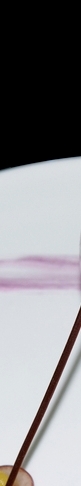 Merry Non-Implant Rhinoplasty, Preserving the Characteristics of Autologous Tissue image 15
