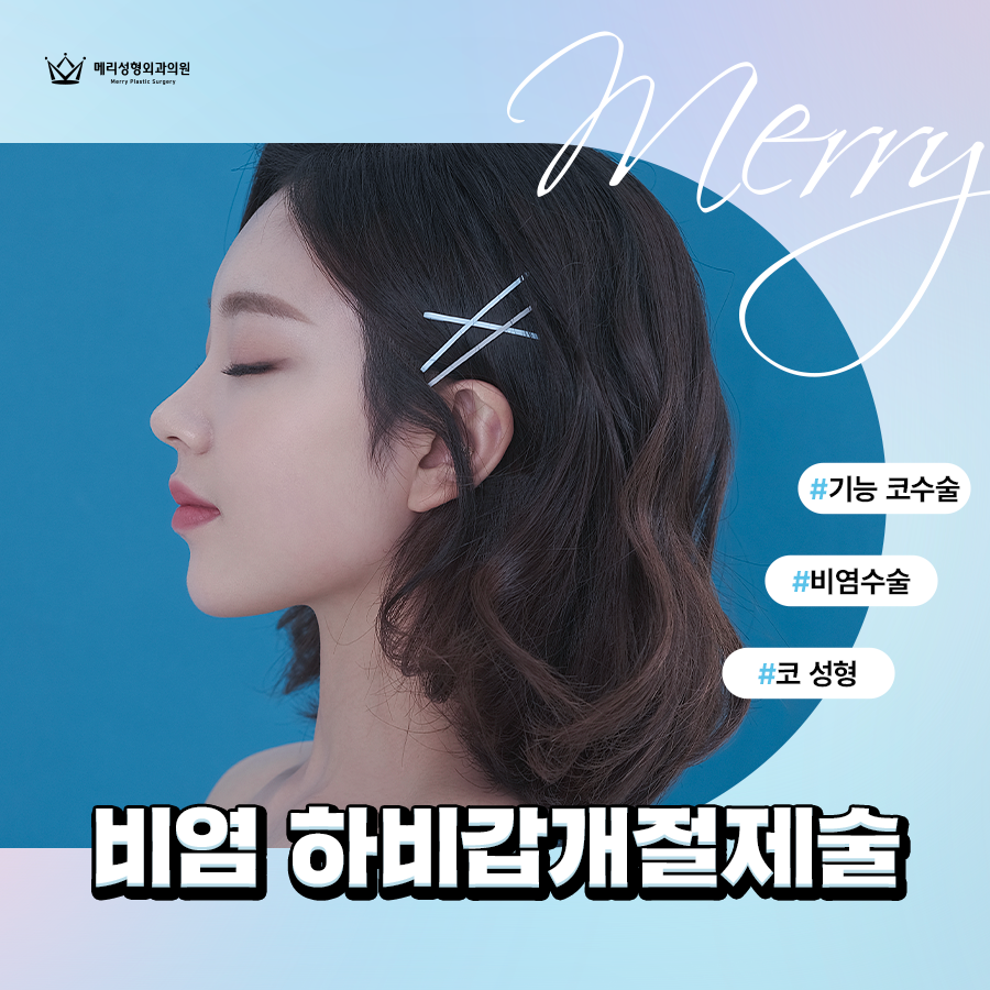 비염 하비갑개절제술 기능 코 성형으로 호흡까지 편한 코 관련 이미지 4