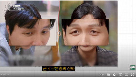 Sunken Upper Eyelids, Eye Hollow :: Filling with Filler, Side Effects, Drooping Eyelids, Gubonseung’s Sunken Upper Eyelids, Lee Dong-wook’s Eye Hollow, Double and Triple Eyelids image 1