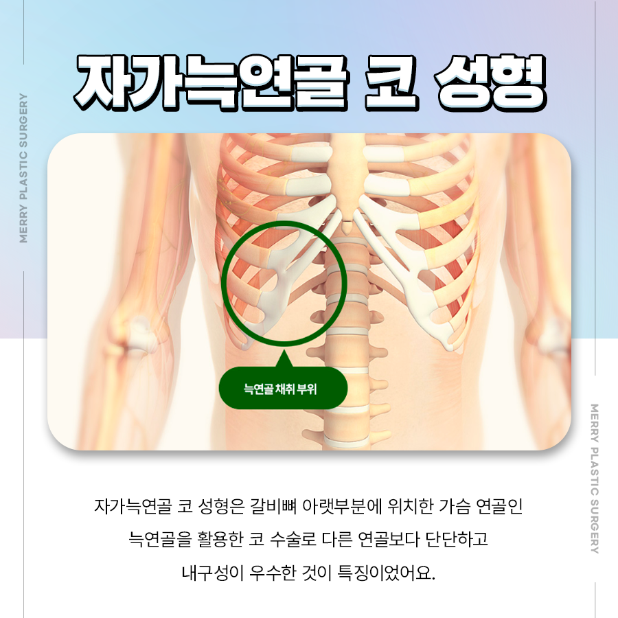 자가늑연골 코성형 후기와 방법 살펴봐야 하는 이유 관련 이미지 3
