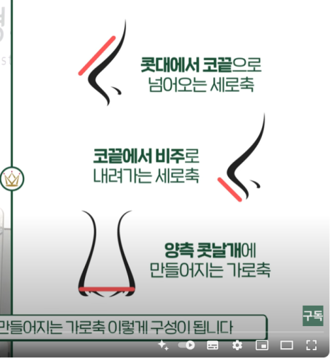 코끝, 콧대만 신경 쓰셨나요? 비주 모양이 코성형의 완성도를 좌우합니다 관련 이미지 3