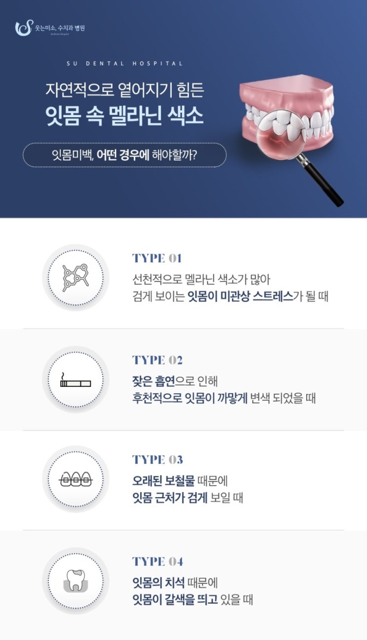 압구정로데오역치과, 치과의사가 말하는 잇몸성형 관련 이미지 4
