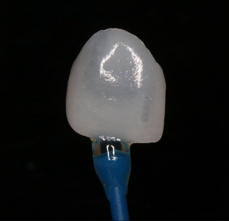 When and Why Is a One-Day Laminate Re-treatment Needed?? image 3