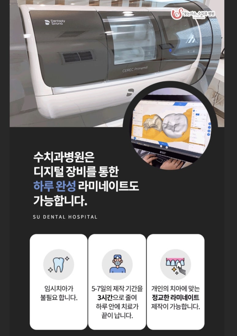 강남구청 원데이 라미네이트, 세렉 캐드캠 시스템 관련 이미지 2