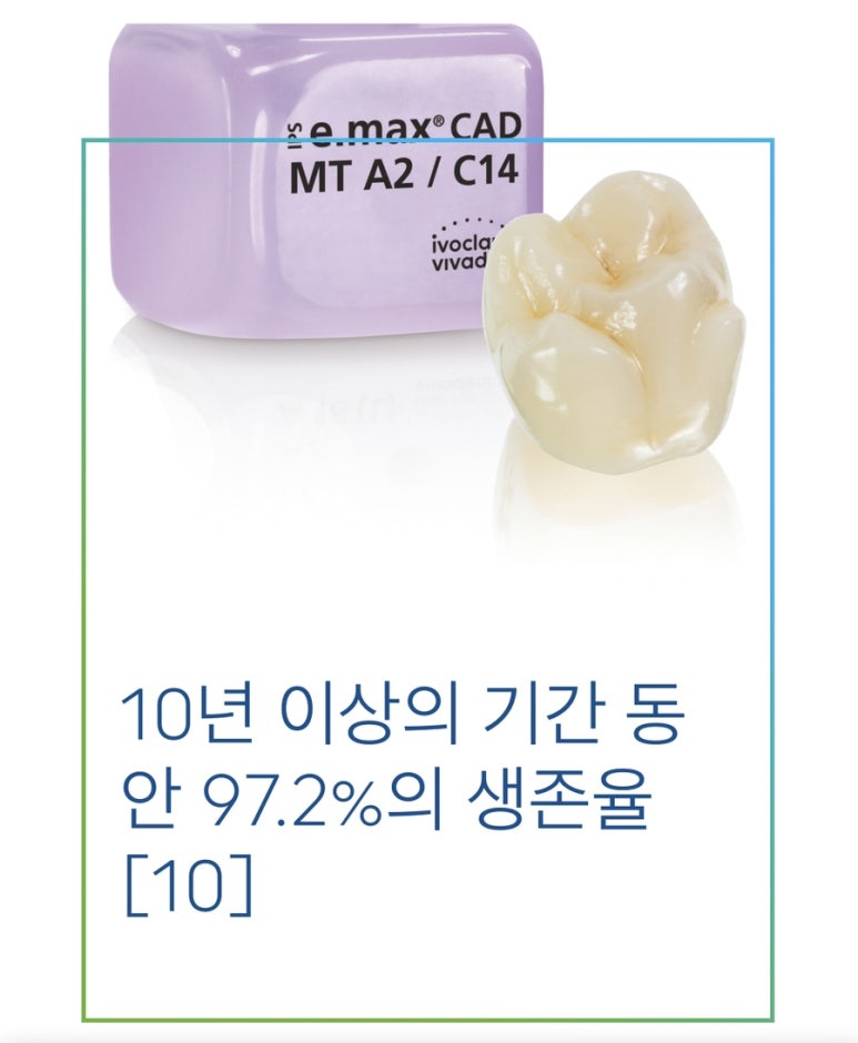 강남구청 원데이 라미네이트, 세렉 캐드캠 시스템 관련 이미지 3