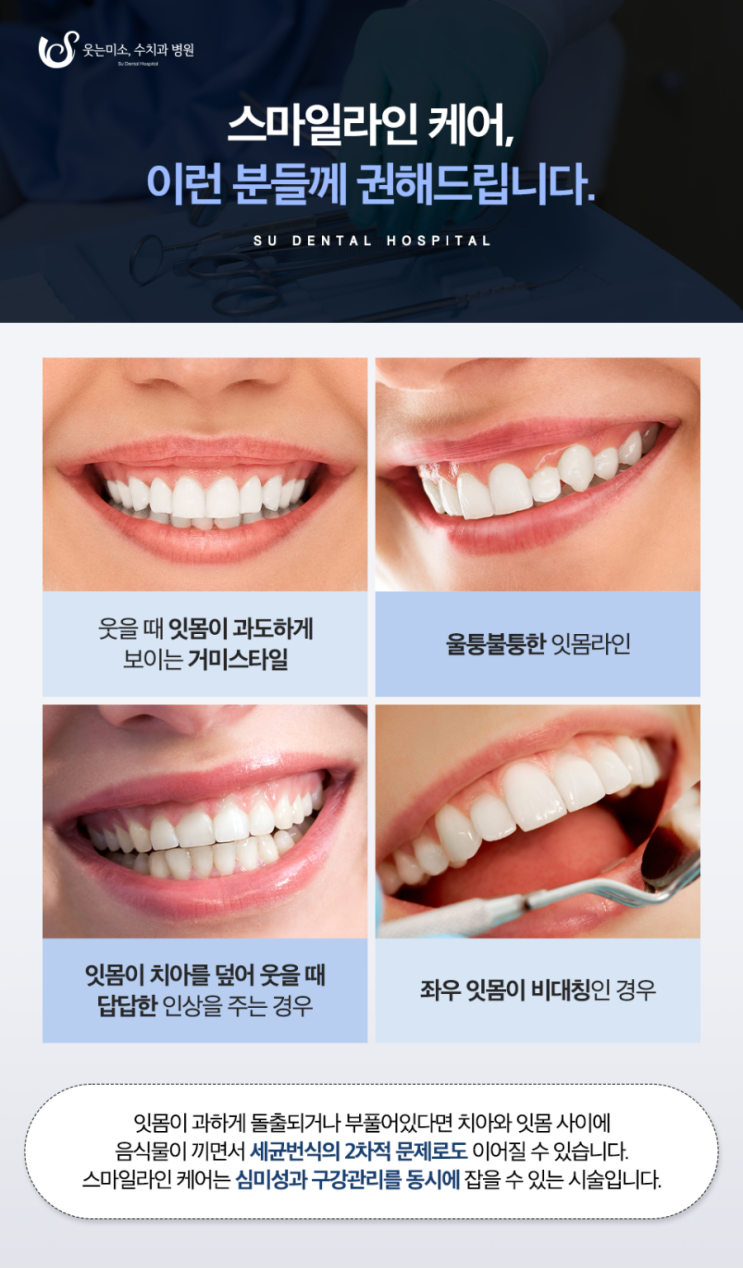 논현동치과, 잇몸에 관해 현직 치과의사가 직접 정리합니다. 관련 이미지 9
