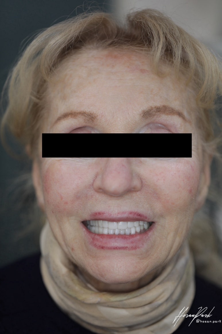 압구정 시니어 라미네이트, 나이는 문제가 되지 않습니다 관련 이미지 4