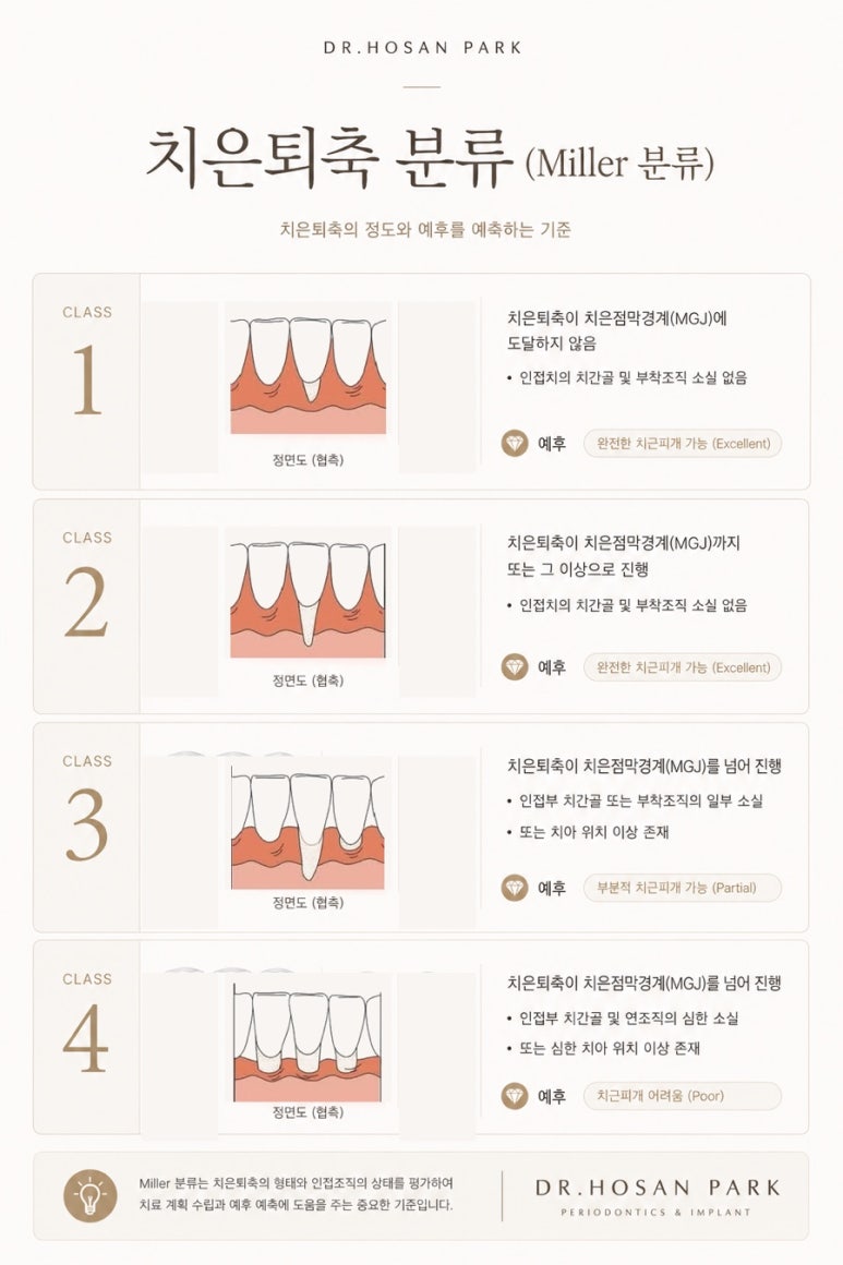 잇몸내려앉음, 약먹는 대신 콜라겐 매트릭스로 커버하시죠 관련 이미지 4