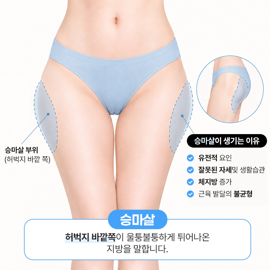 끝까지 안 빠지는 승마살, 허벅지지방추출주사로 허벅지살빼는법 관련 이미지 2