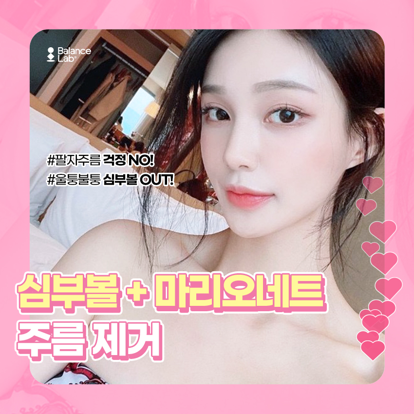 불독살심부볼 제거와 마리오네트리프팅이 필요한 경우는? 관련 이미지 1