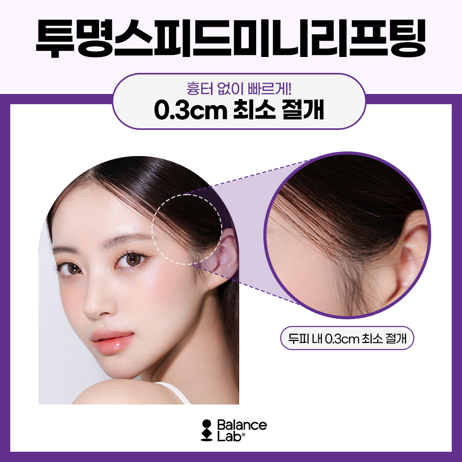 투명한 흉터로 스피드 리프팅! 미니리프팅 병원에서😉 관련 이미지 3