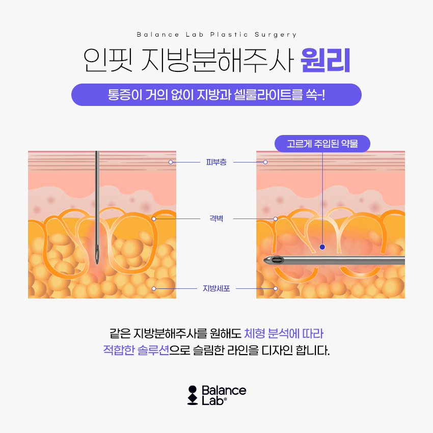 복부지방분해주사 가격 부담 없이 몸무게를 줄이는 강남비만클리닉 관련 이미지 5